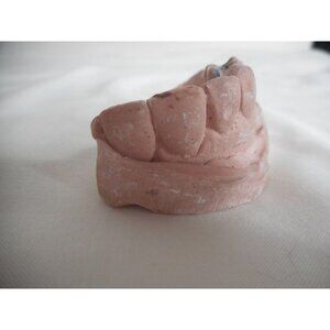 Vintage Cast Dental Teeth Mold  Tooth Castings Medical Oddity #4